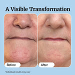 20% Vitamin C + E Ferulic Acid Serum